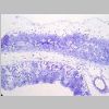 Intestino grueso SF 02.jpg